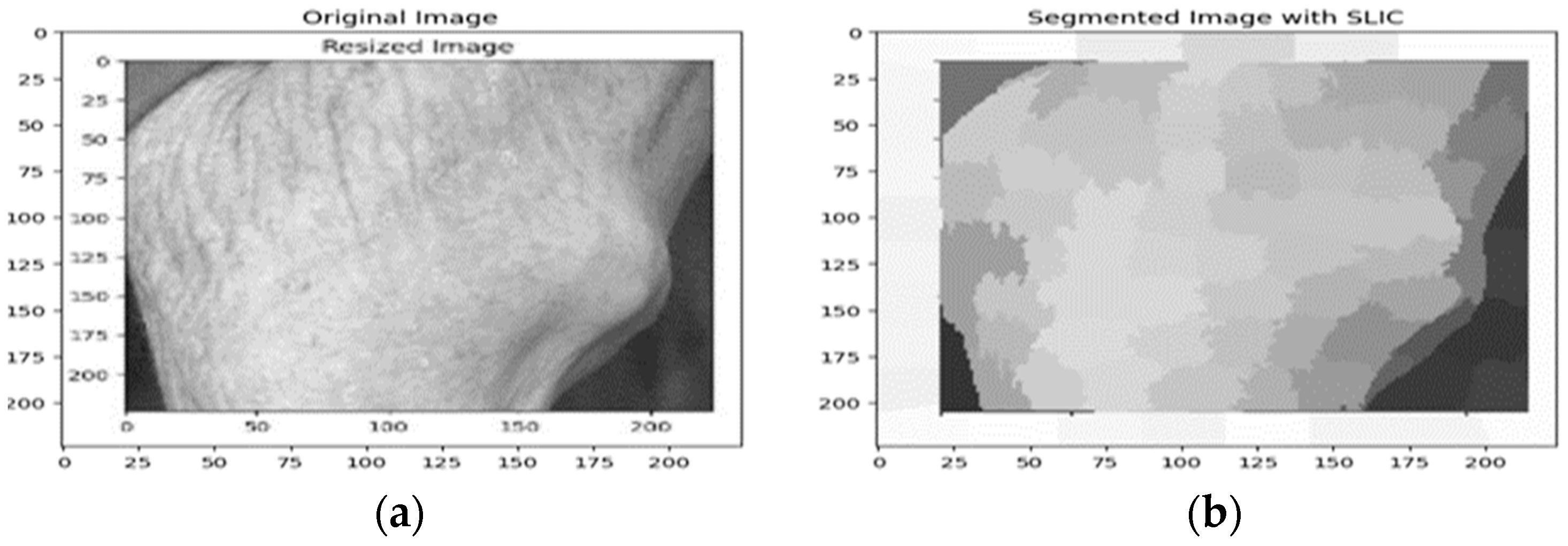 Rheumato 04 00014 g002