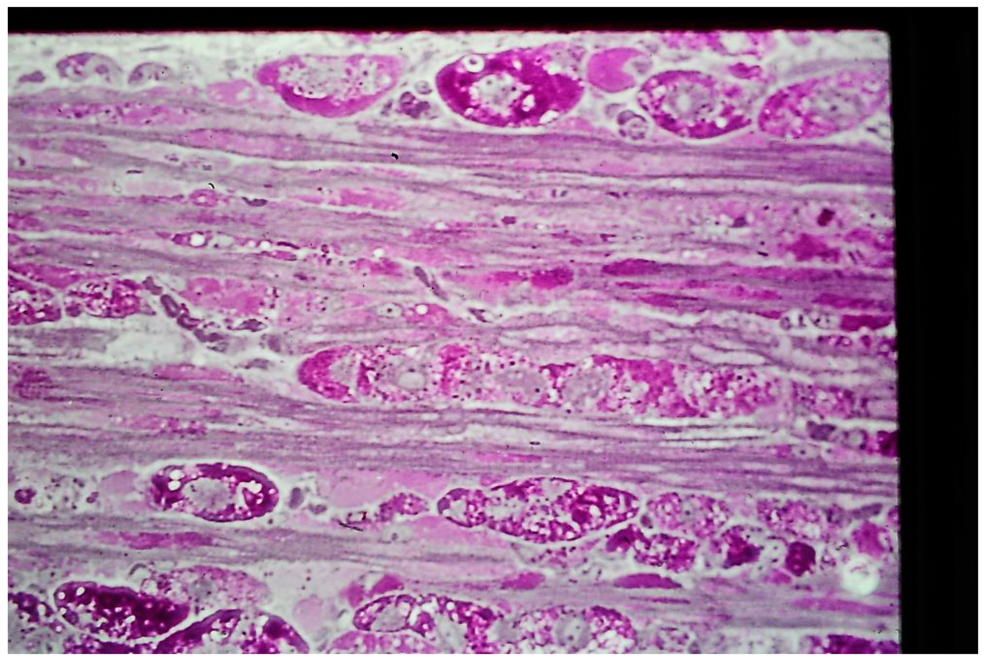 Rheumato 05 00002 g001