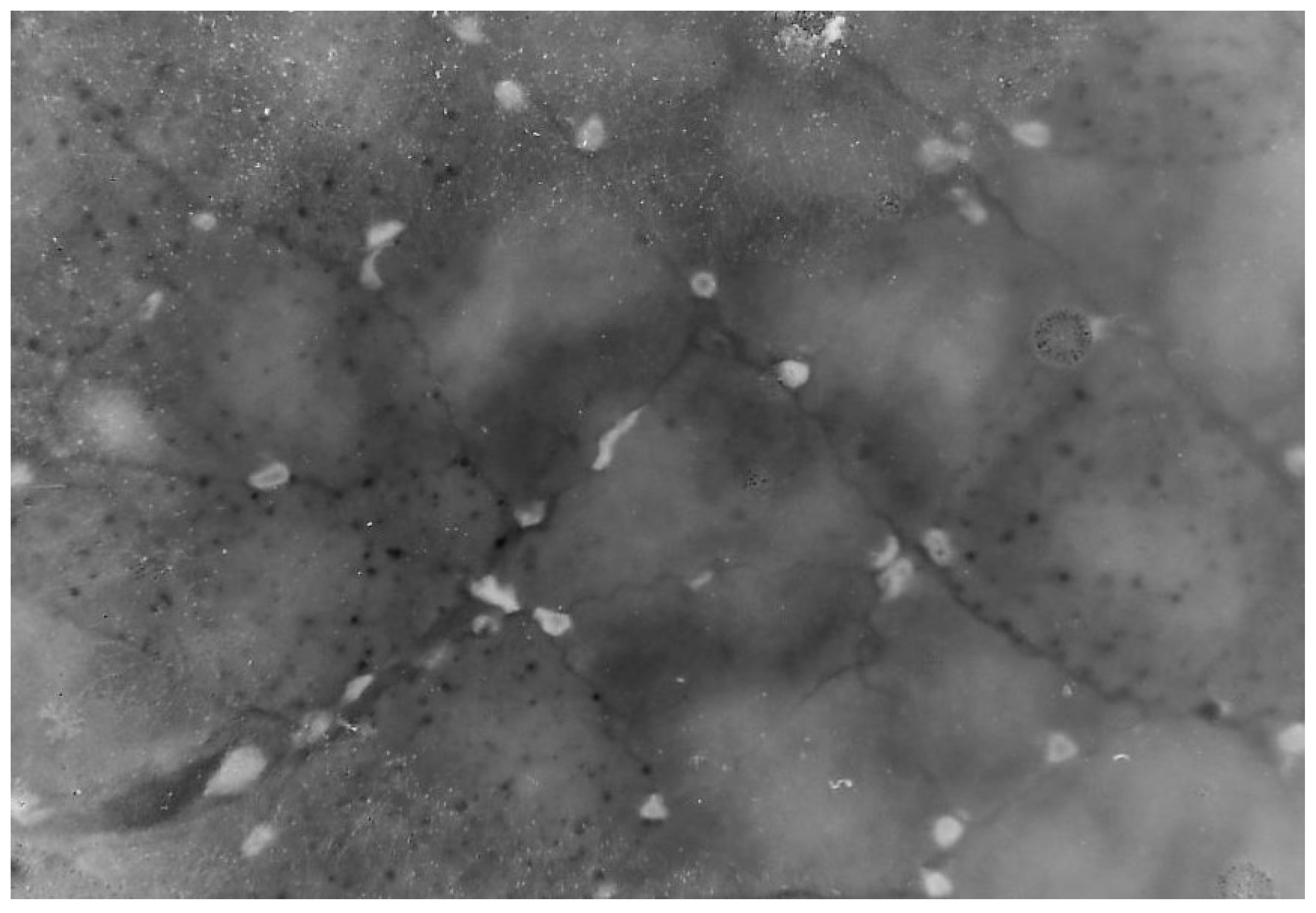 Rheumato 05 00002 g003