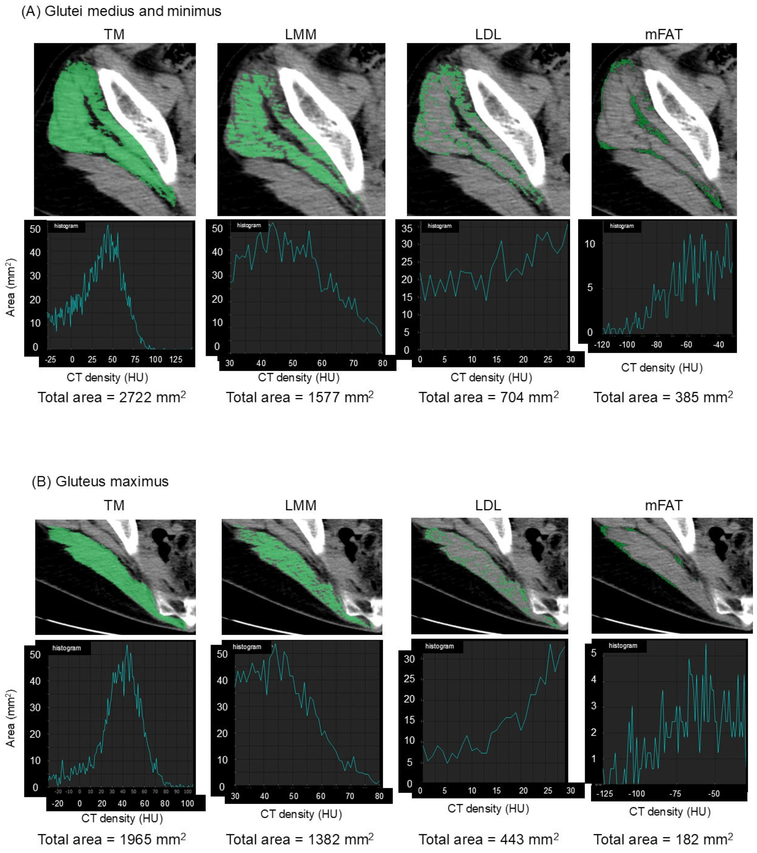 Rheumato 05 00006 g001