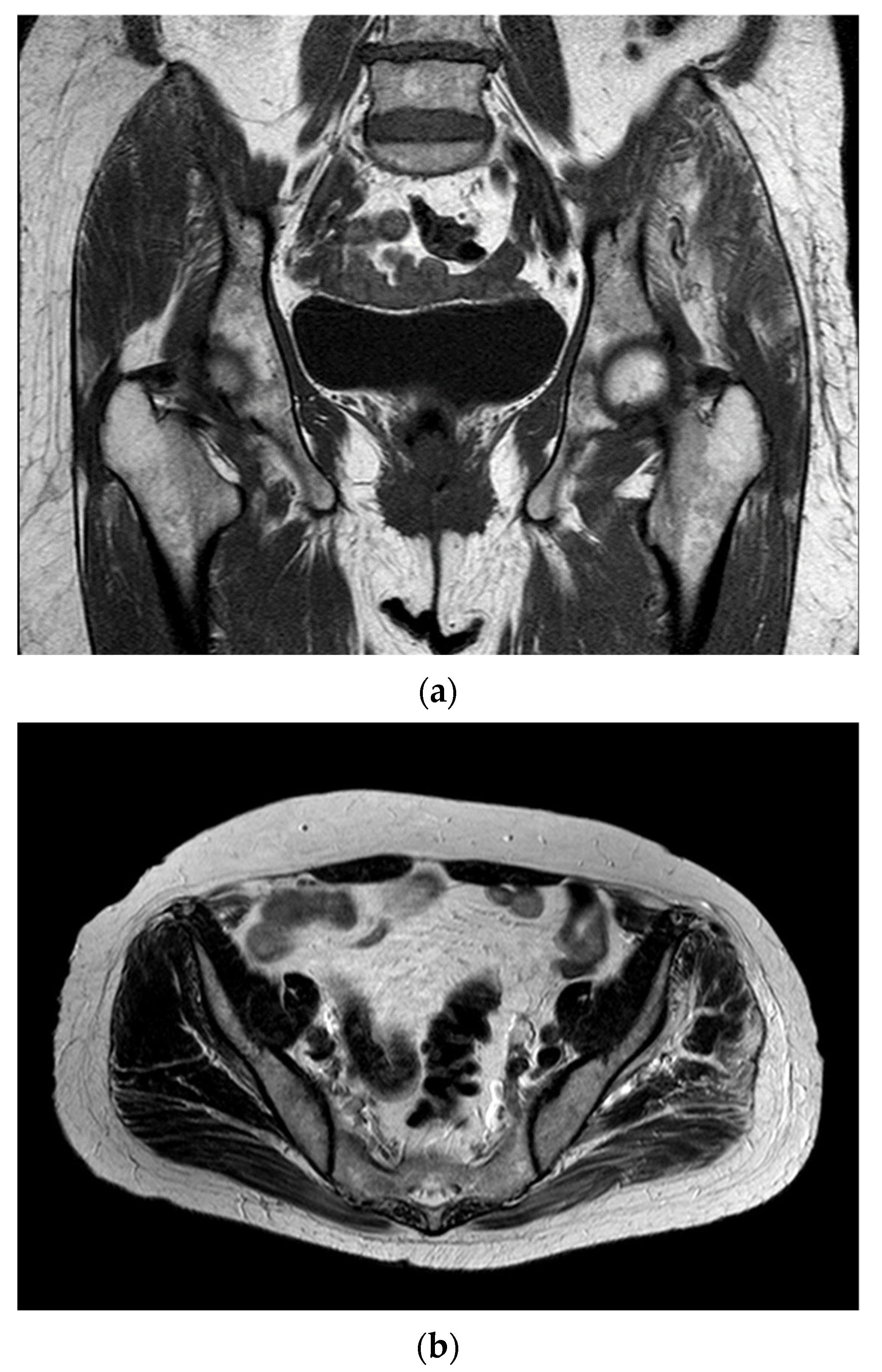 Rheumato 05 00007 g001