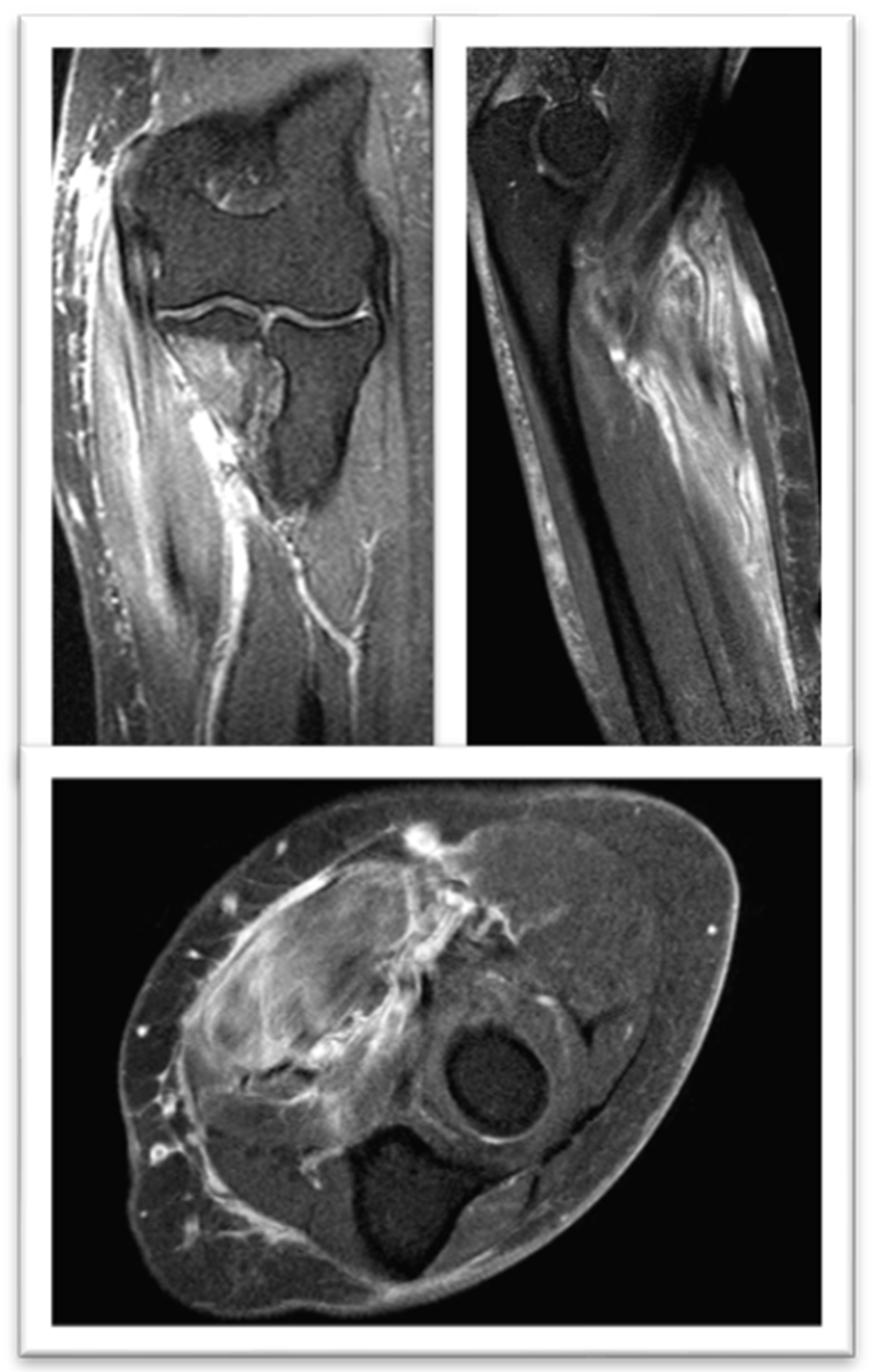 Rheumato 05 00007 g003