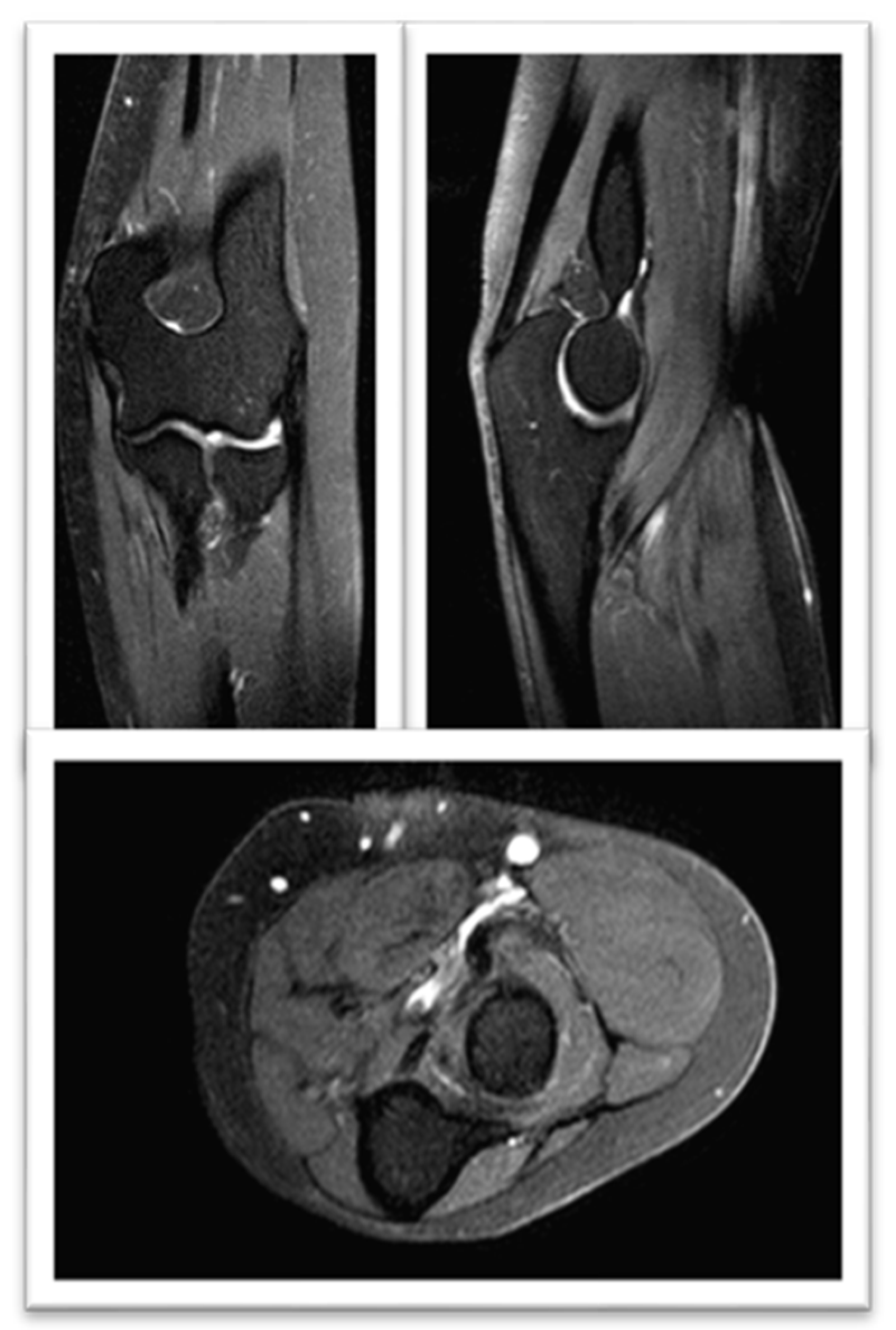 Rheumato 05 00007 g005