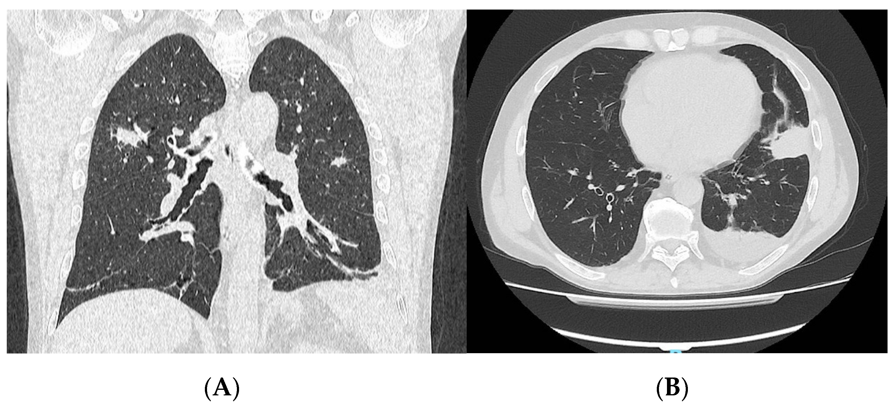 Rheumato 06 00010 g001 Rheumato 06 00010 g001