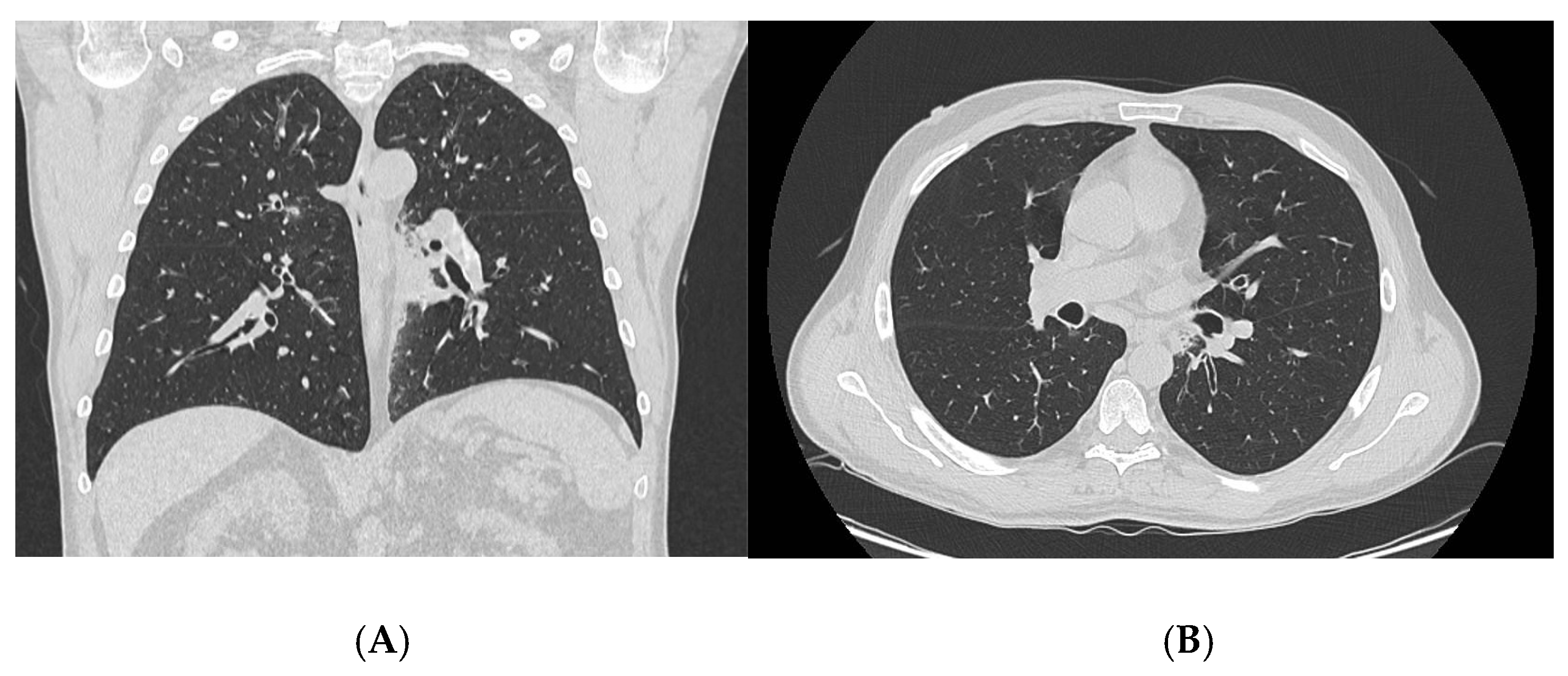Rheumato 06 00010 g003 Rheumato 06 00010 g003
