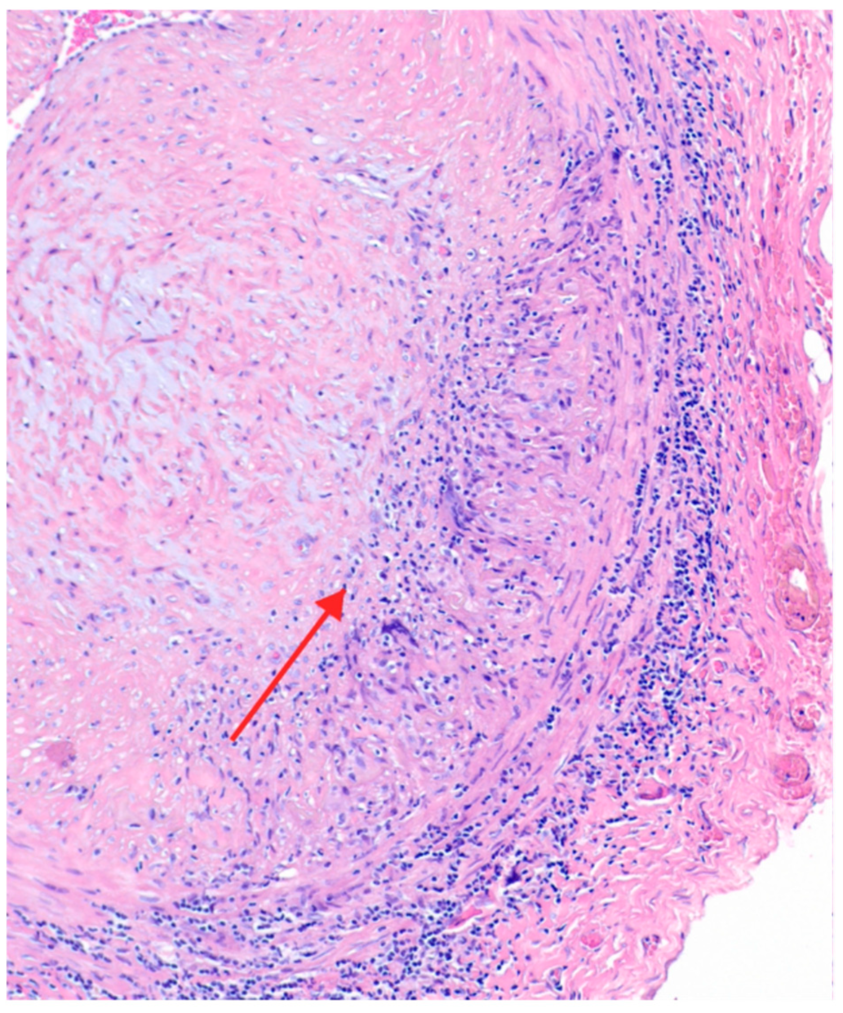 Rheumato 06 00021 g002 Rheumato 06 00021 g002