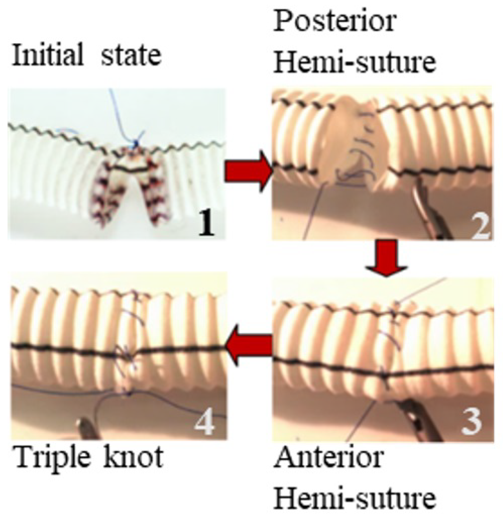 Robotics 09 00062 g014