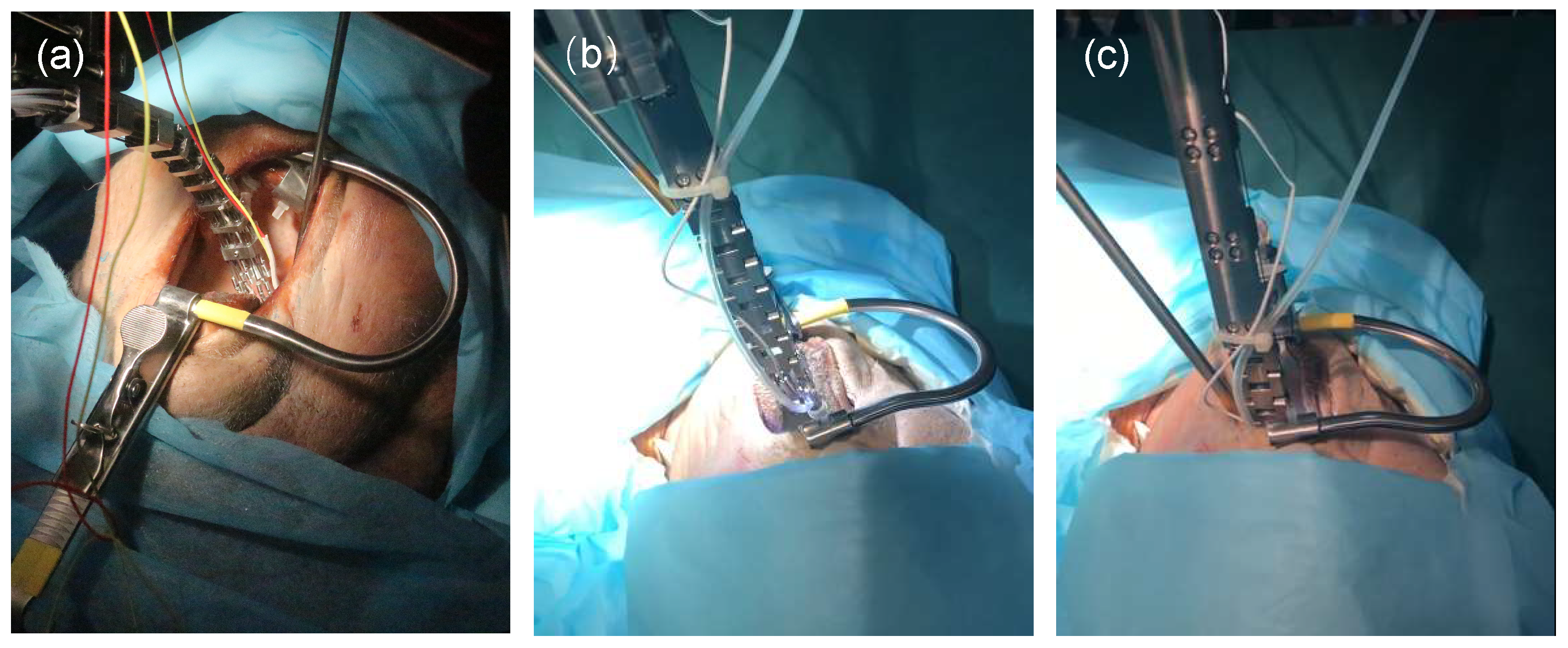 Robotics 11 00135 g003 Robotics 11 00135 g003