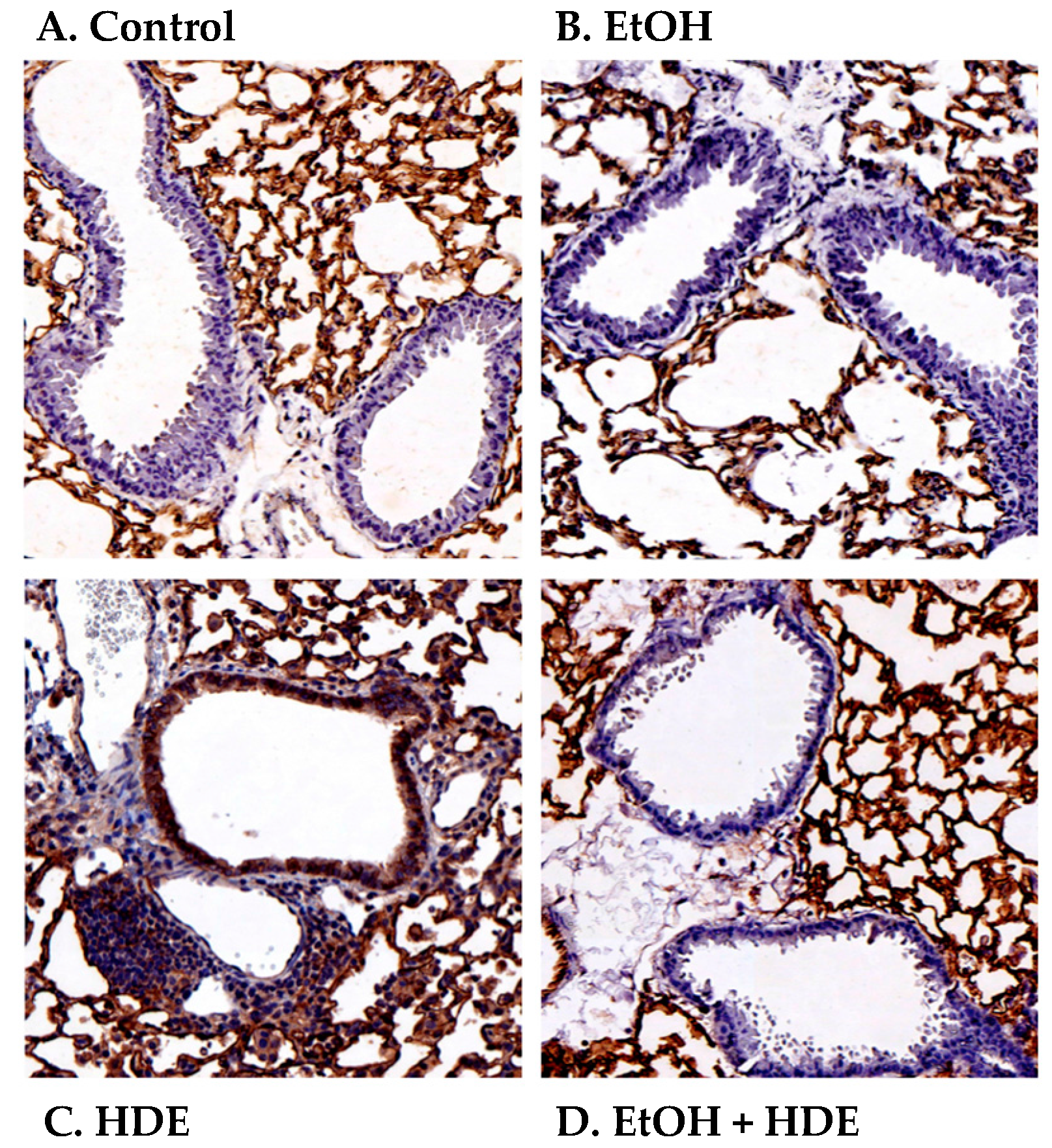 Safety 03 00005 g004