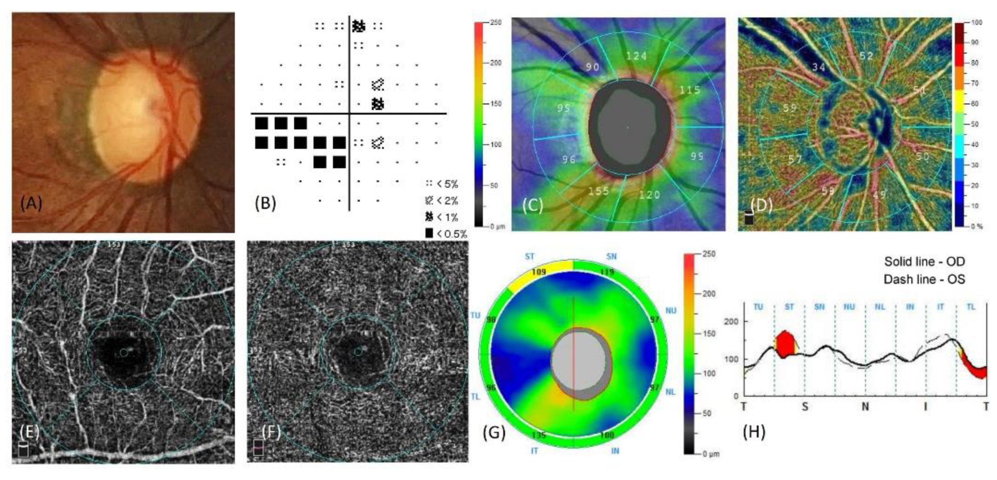 Scipharm 89 00040 g001