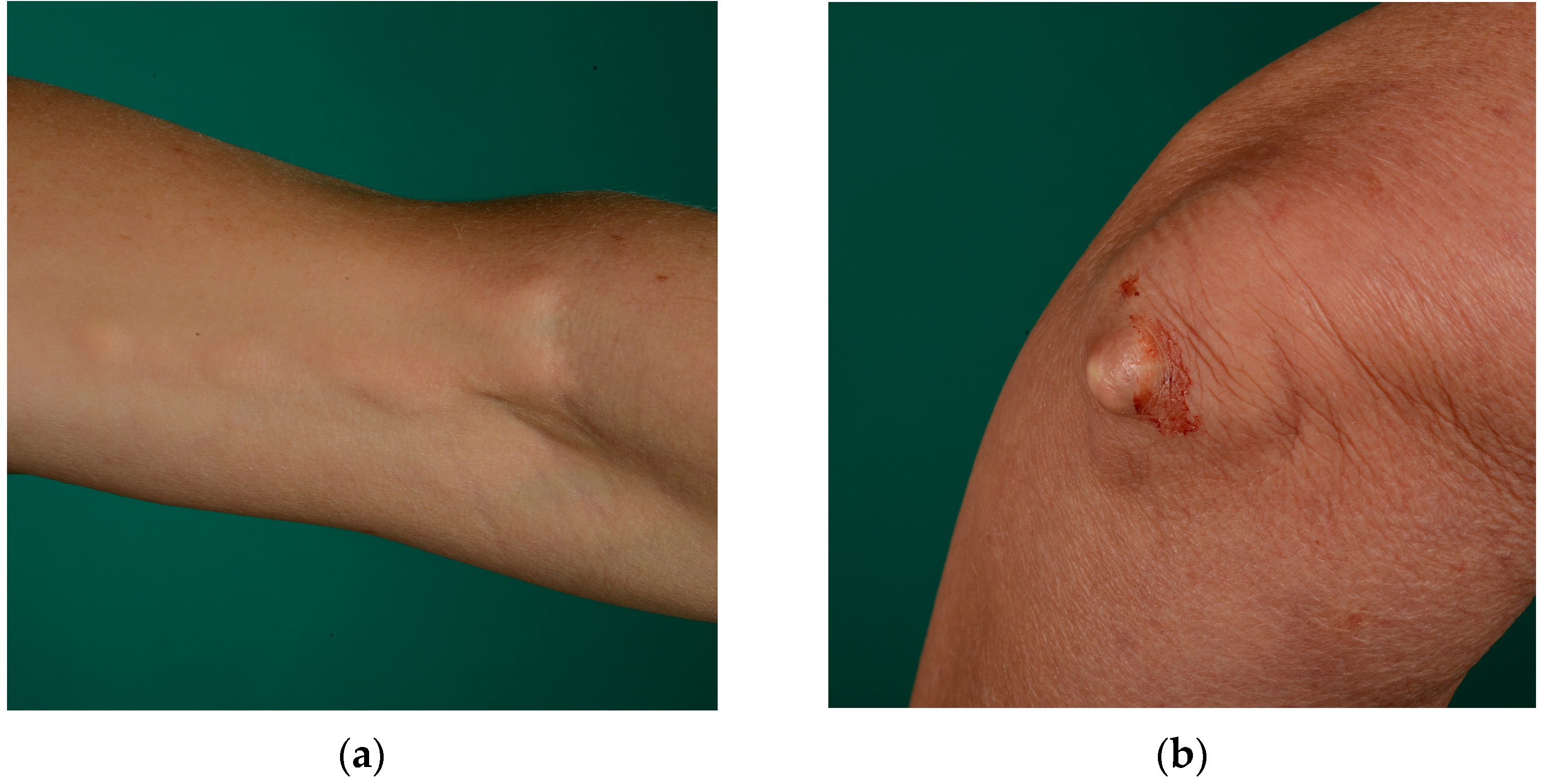 Sclerosis 02 00019 g001 Sclerosis 02 00019 g001