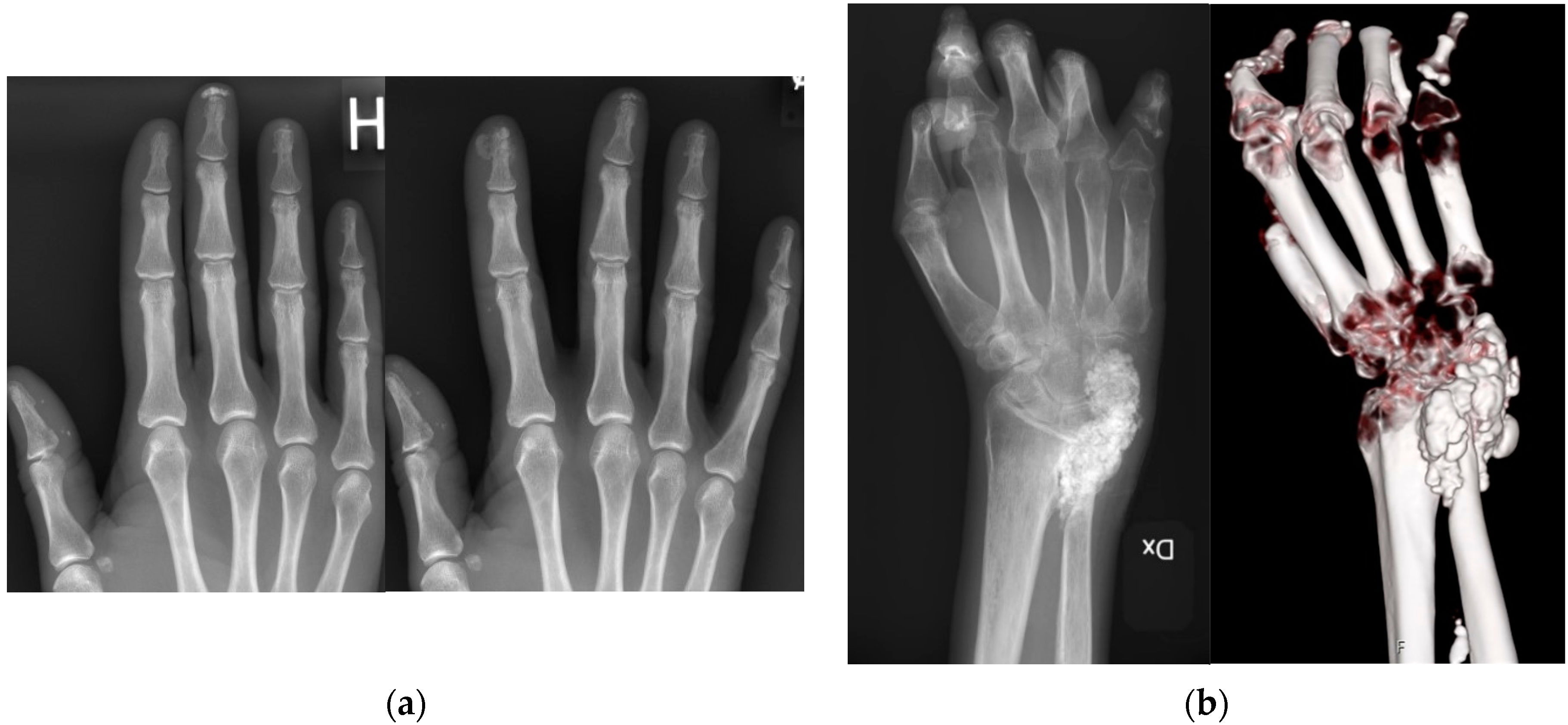 Sclerosis 02 00019 g002 Sclerosis 02 00019 g002