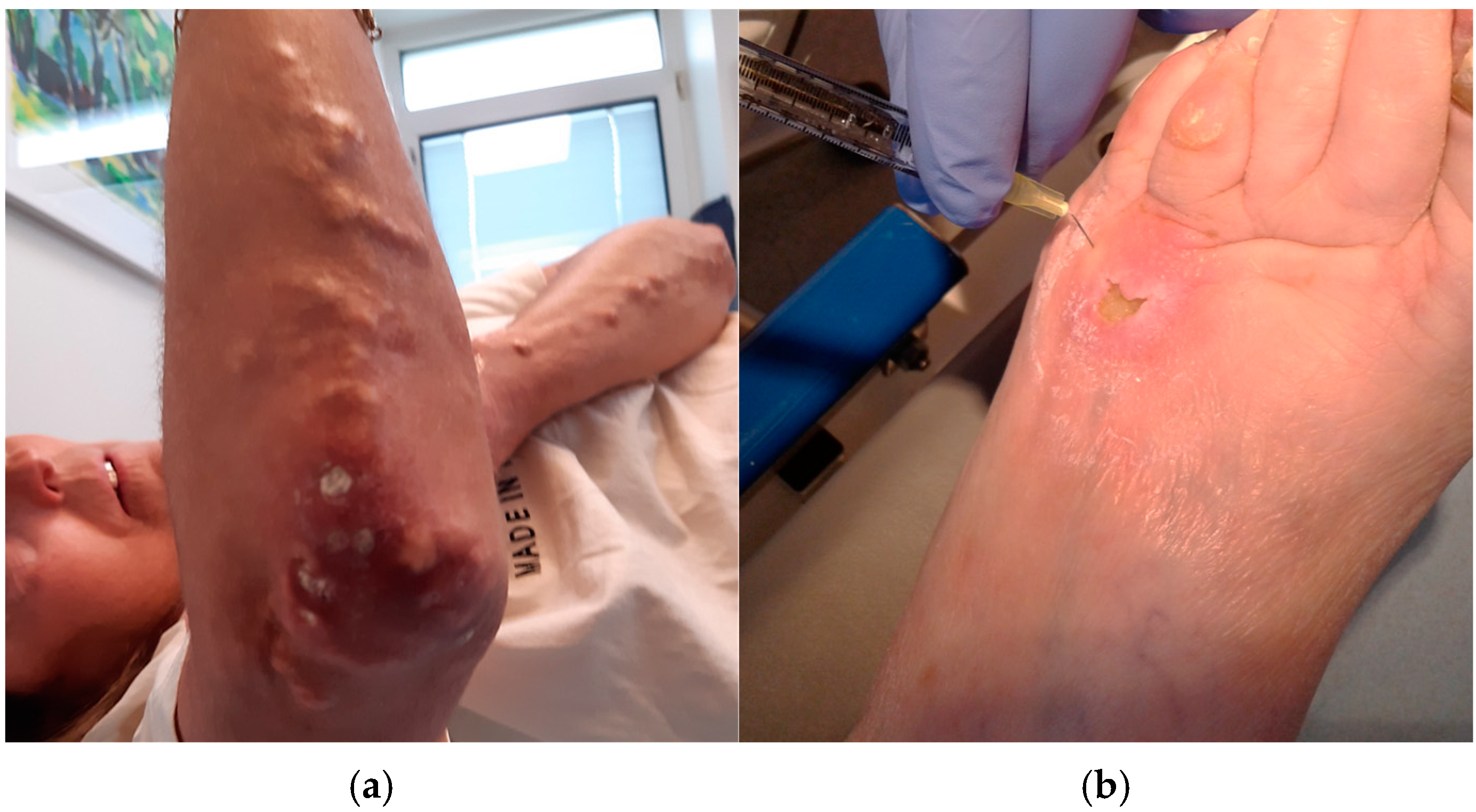 Sclerosis 02 00019 g003 Sclerosis 02 00019 g003