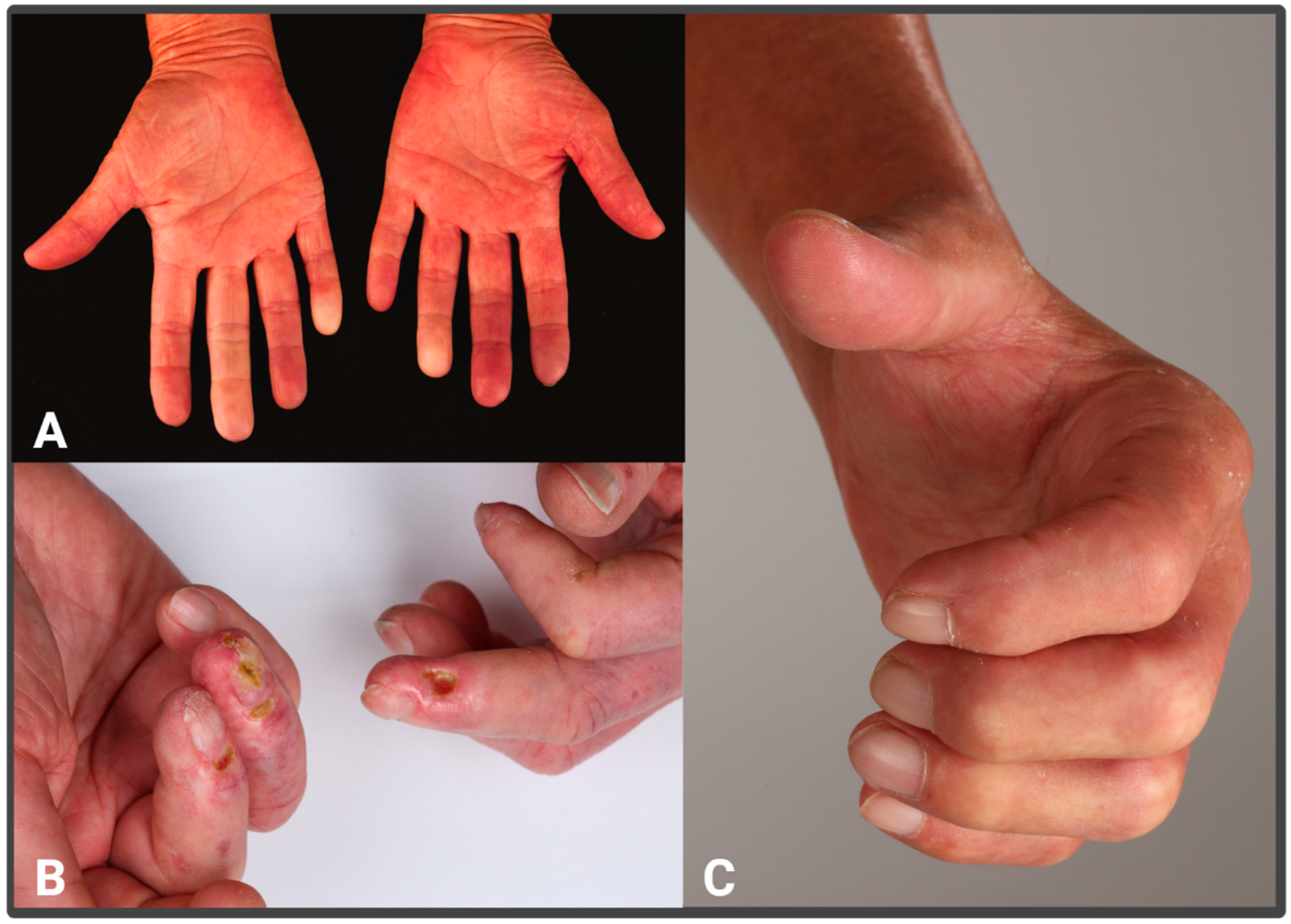 Sclerosis 03 00017 g001