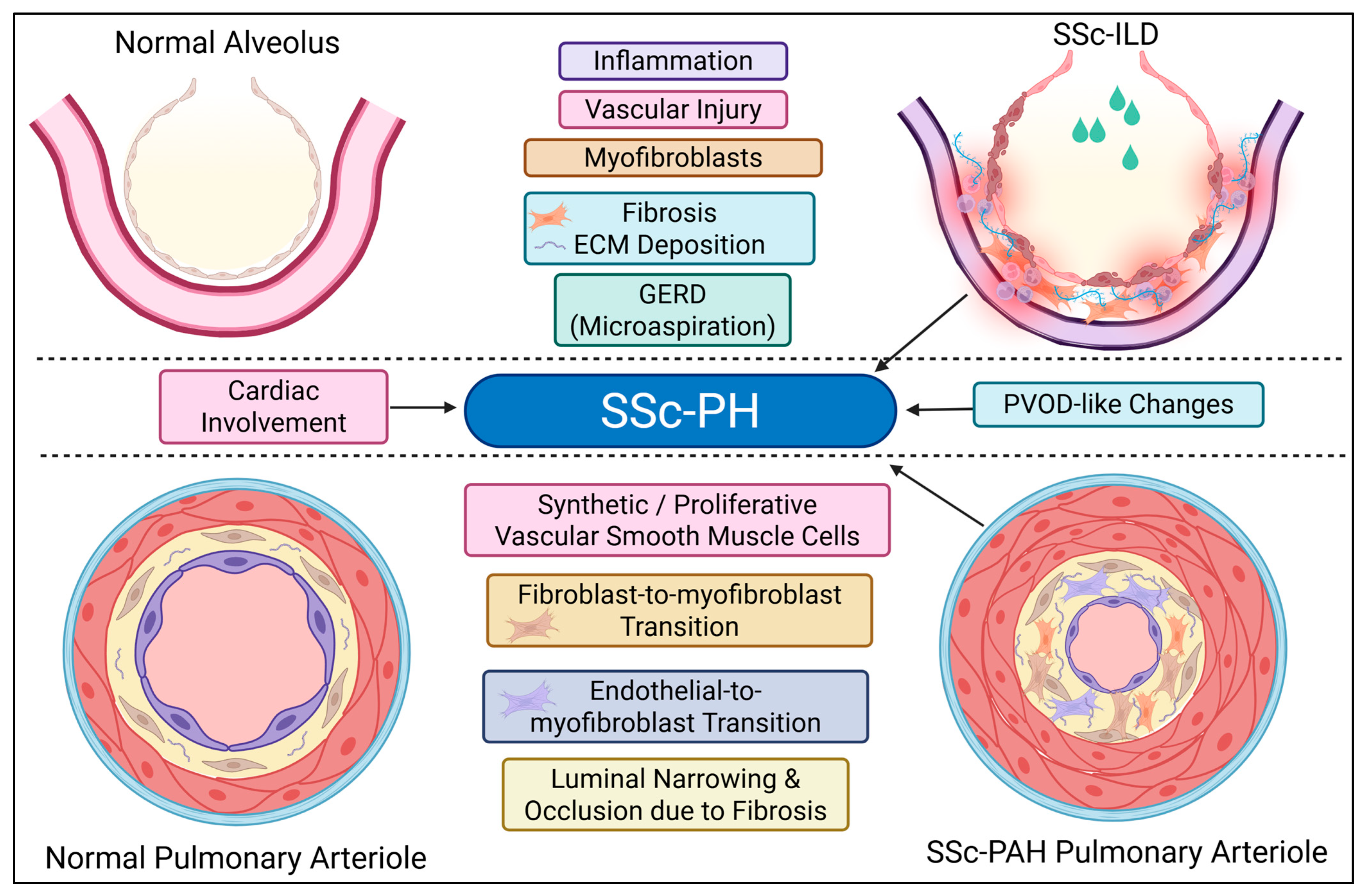 Sclerosis 03 00020 g004