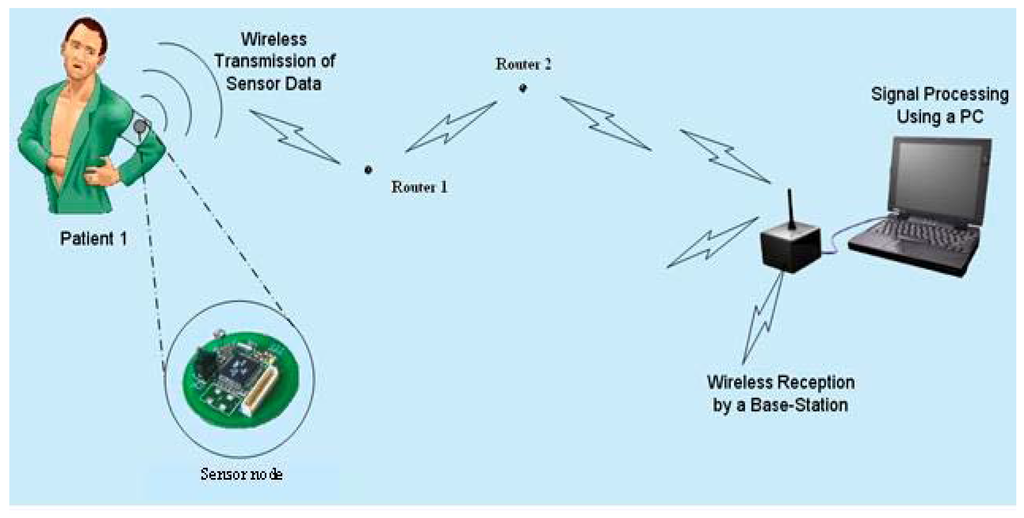 Sensors 06 01102 g001 1024