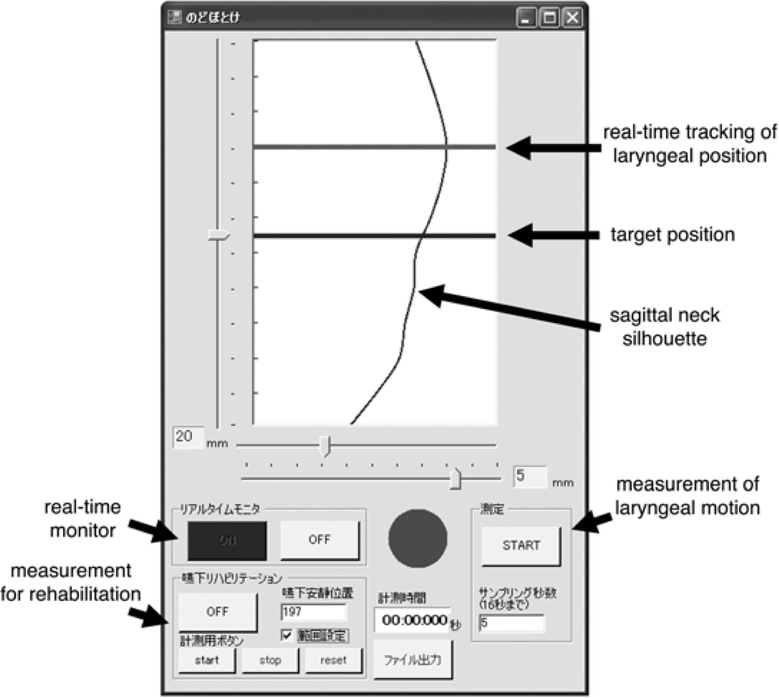 Sensors 10 00176f23