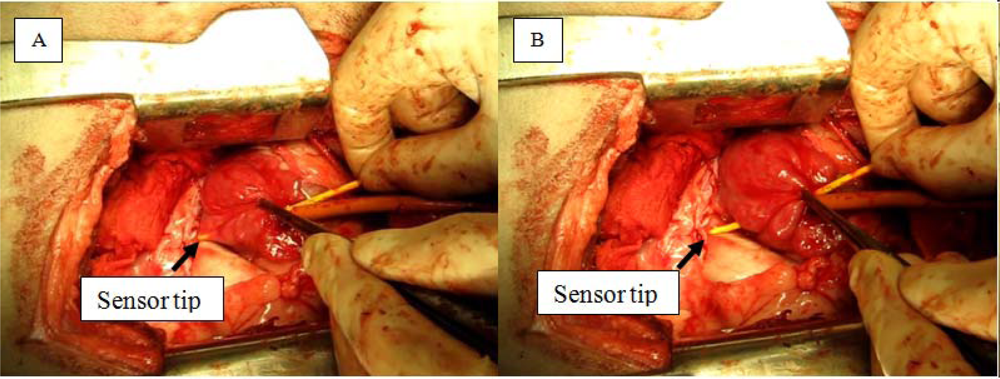 Sensors 12 01002f2 1024