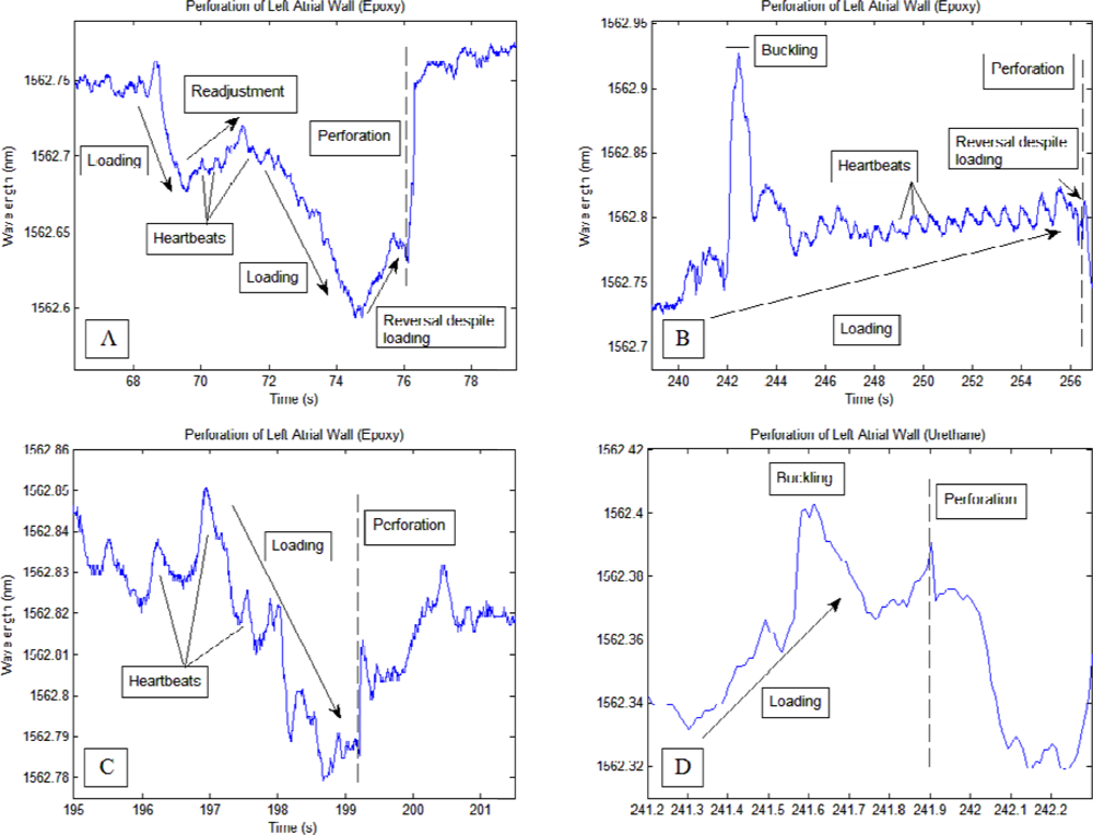 Sensors 12 01002f4a 1024