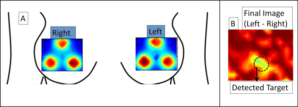 Sensors 12 01885f6 1024