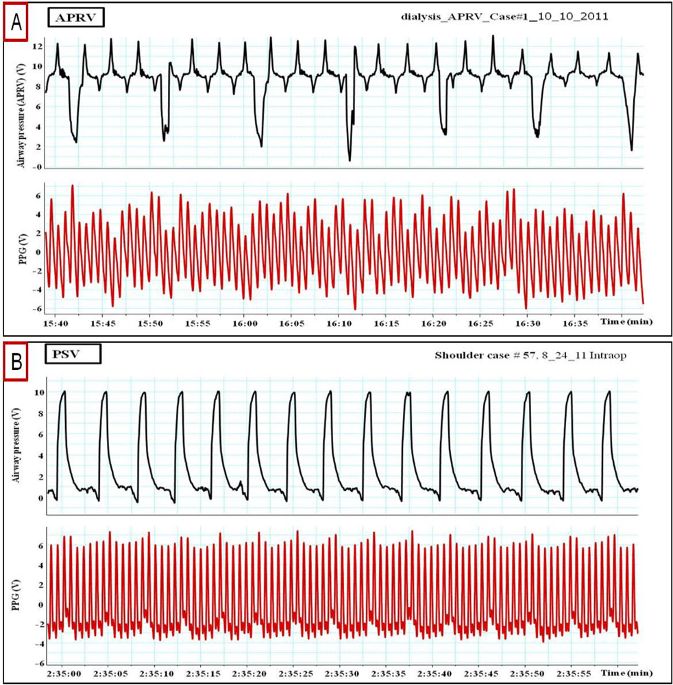 Sensors 12 02236f10 1024