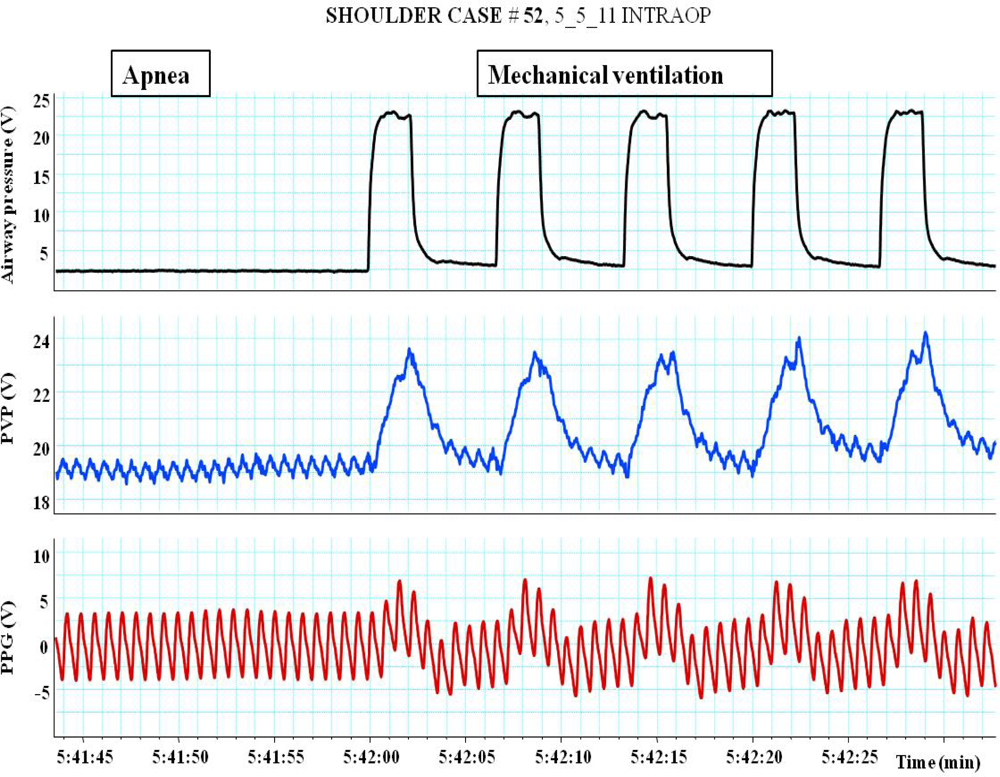Sensors 12 02236f8 1024