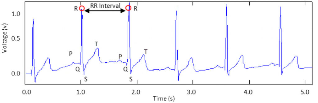 Sensors 13 16451f6 1024