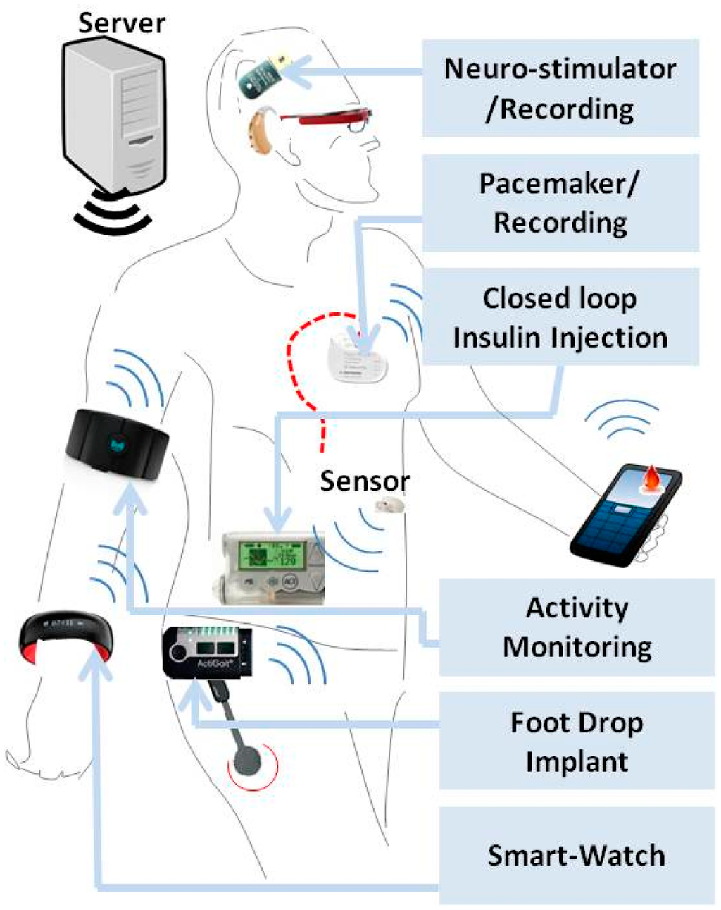 Sensors 15 03236f1 1024