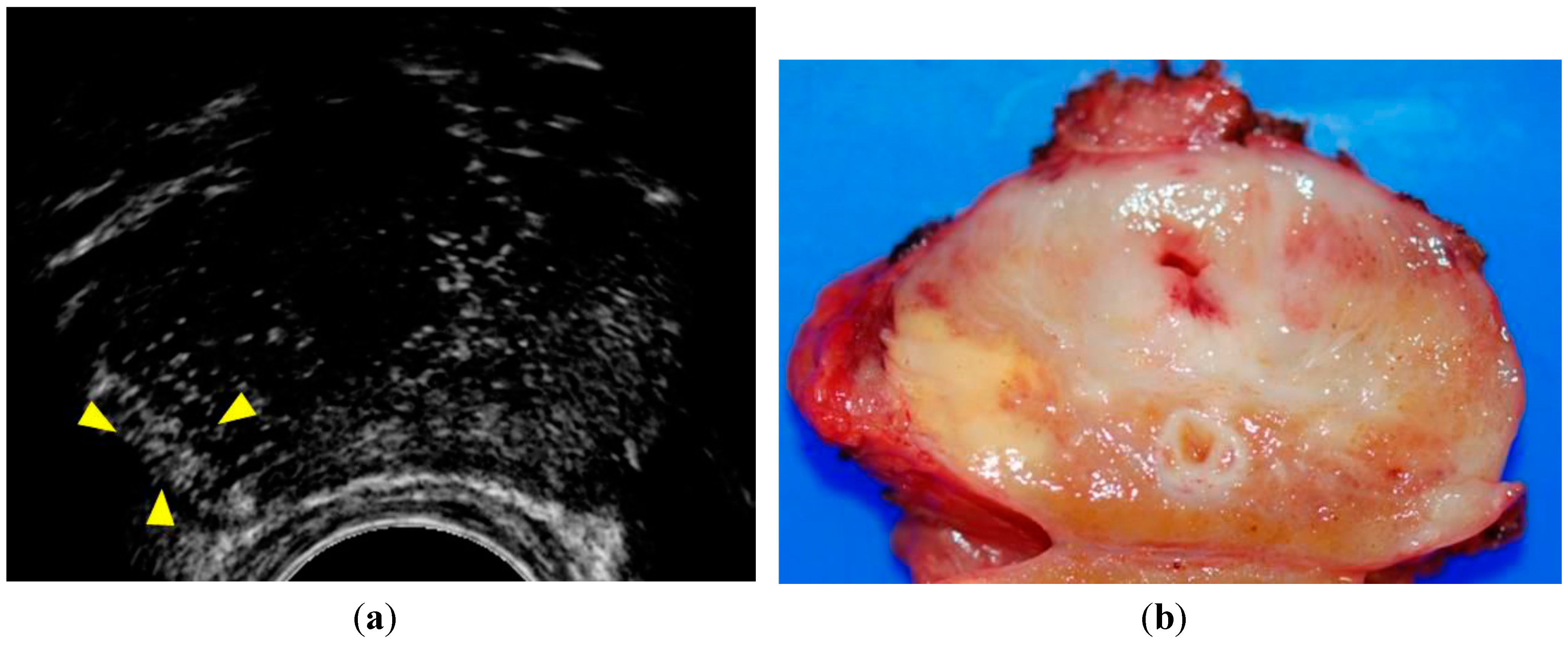 Sensors 15 04947 g001