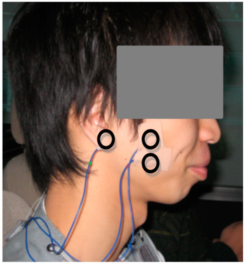 Sensors 15 05136 g004 1024