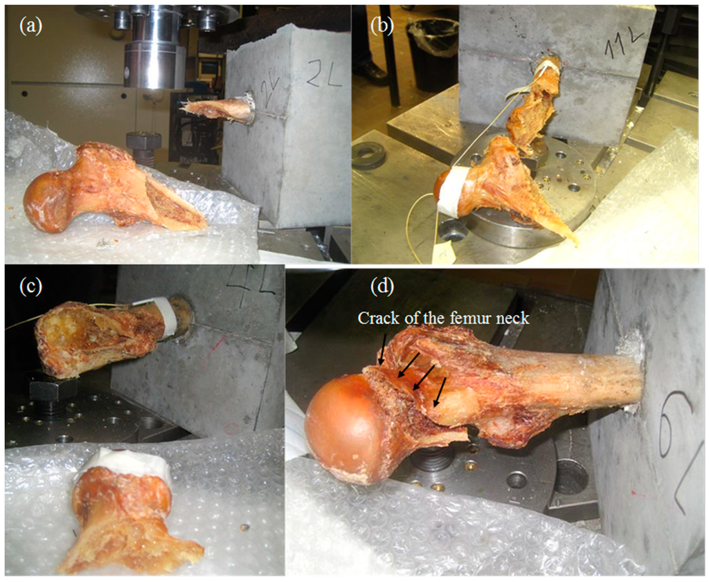 Sensors 15 05803 g008 1024