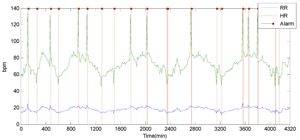 Sensors 15 06066 g009 1024