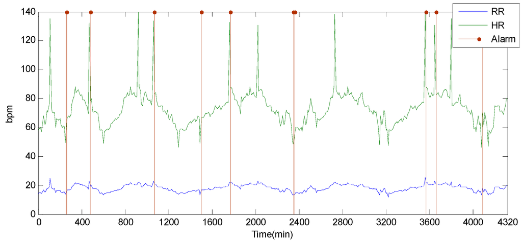Sensors 15 06066 g010 1024