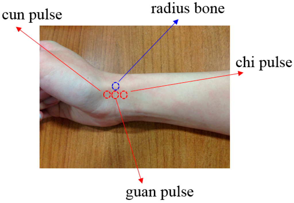 Sensors 15 09899 g001 1024