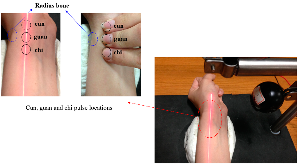Sensors 15 09899 g015 1024