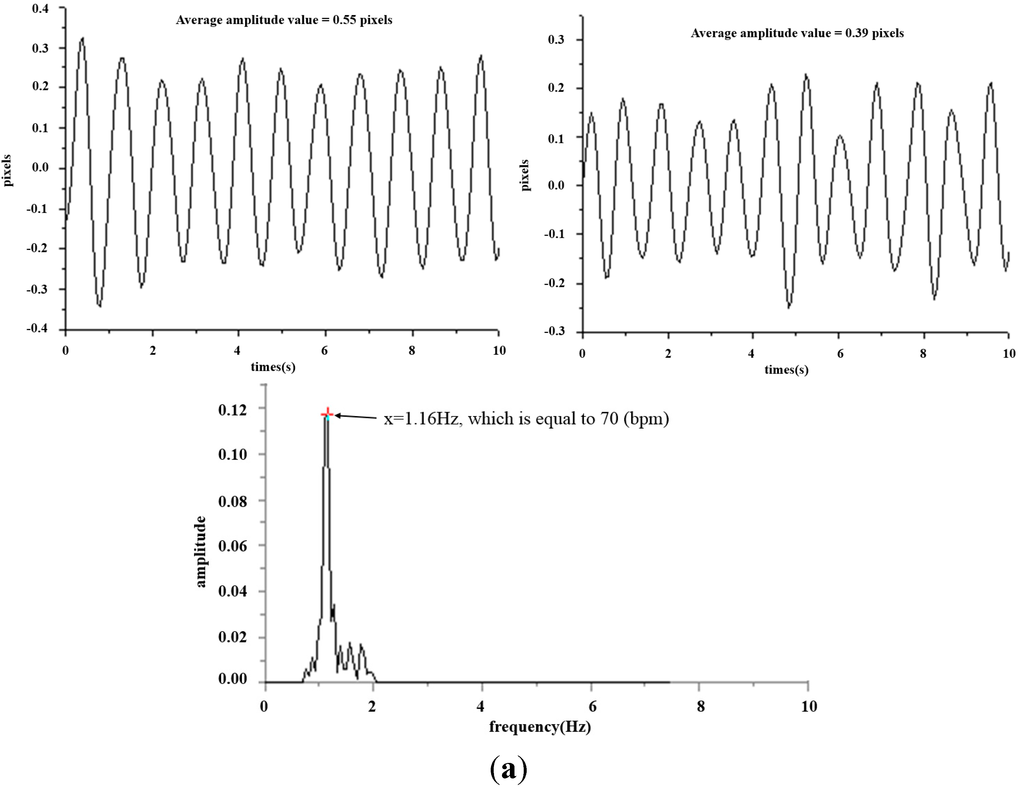 Sensors 15 09899 g018a 1024