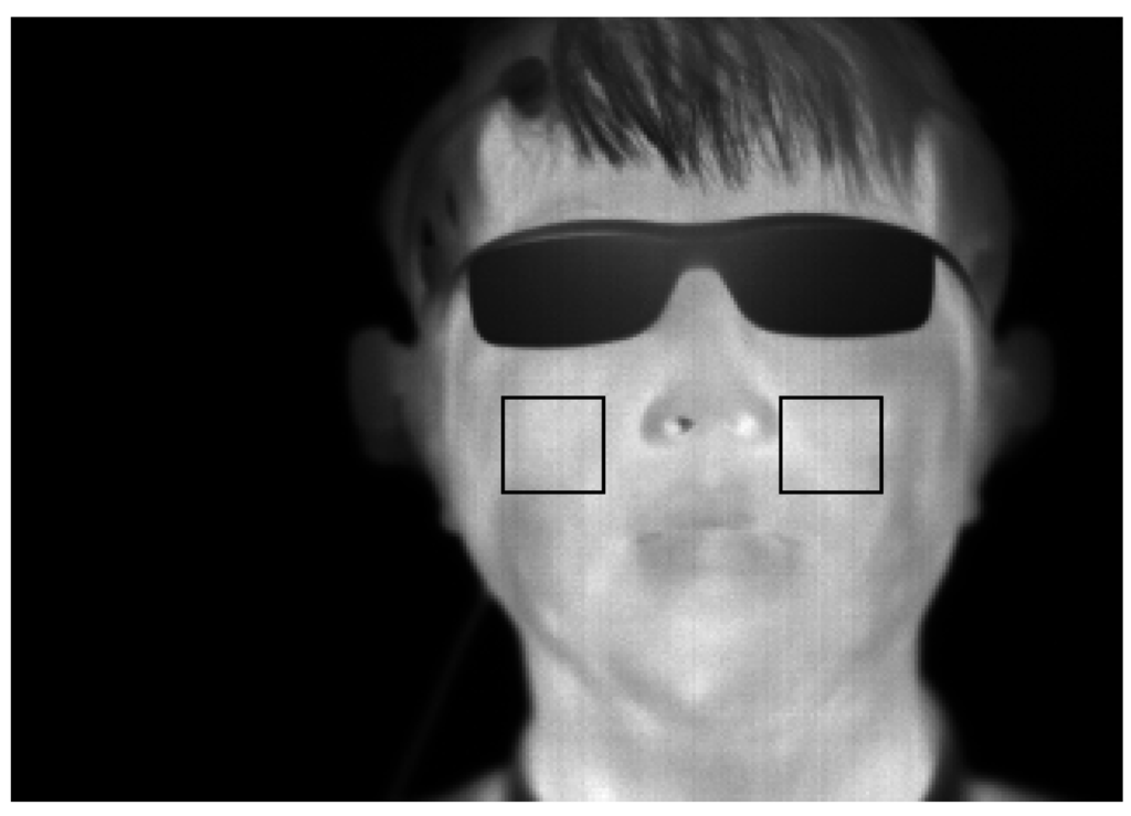 Sensors 15 10825 g007 1024