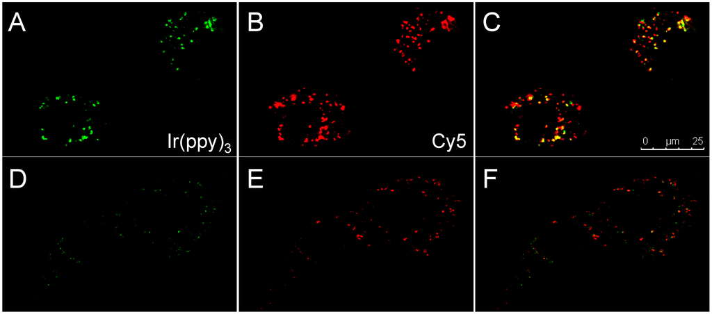 Sensors 15 11076 g005 1024