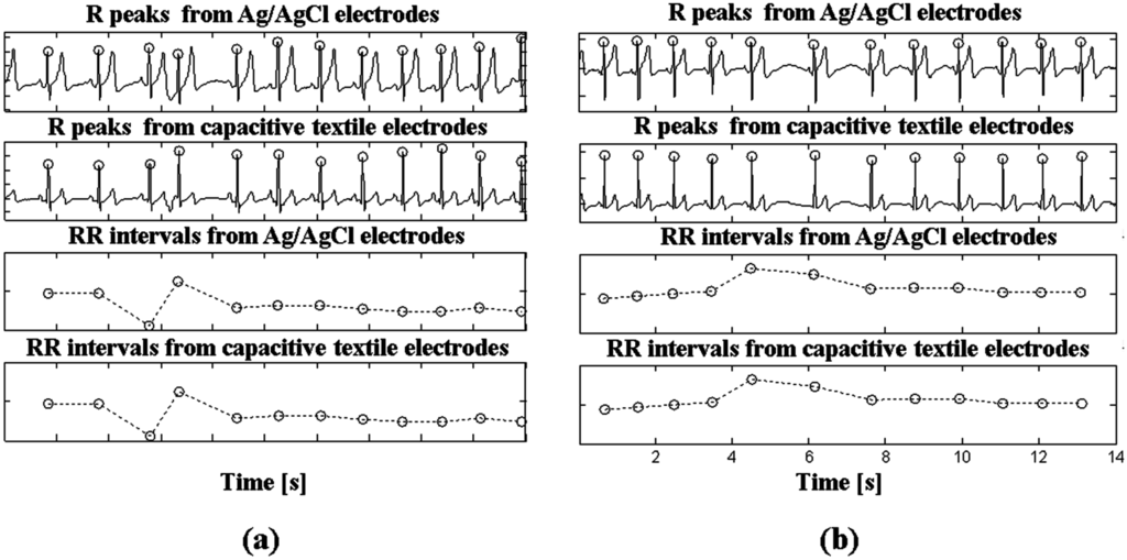 Sensors 15 11295 g005 1024