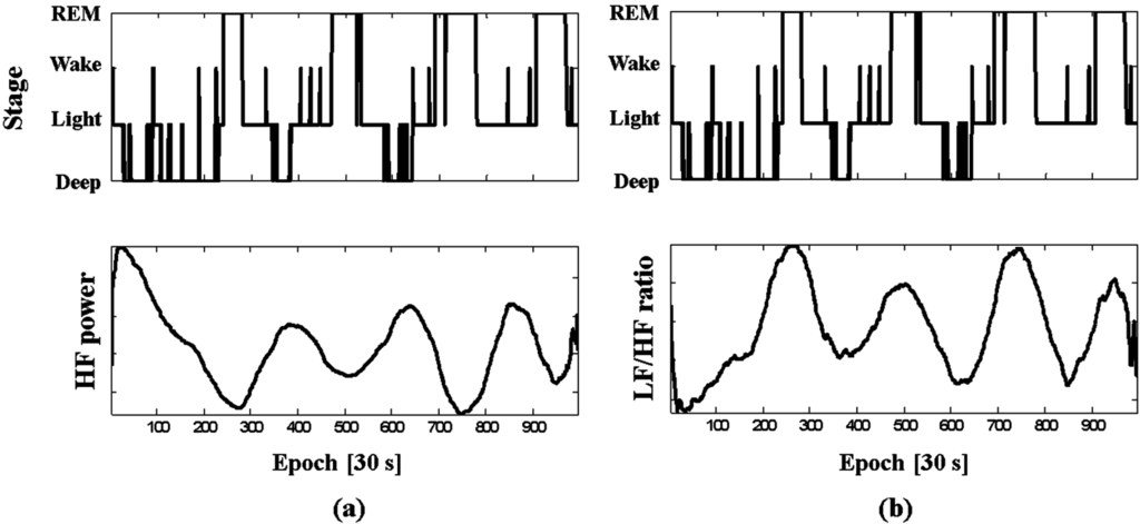 Sensors 15 11295 g008 1024
