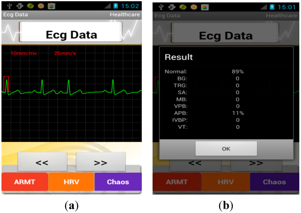 Sensors 15 11465 g009 1024