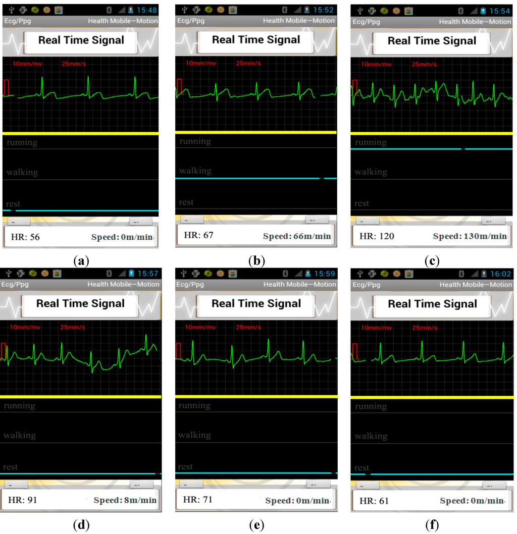 Sensors 15 11465 g011 1024