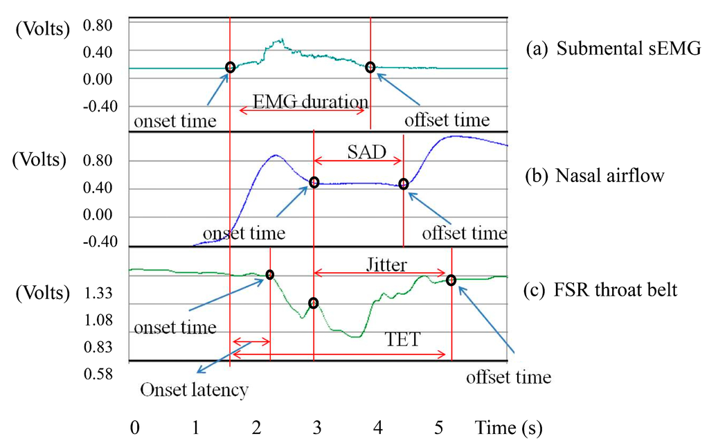 Sensors 15 12428 g006 1024