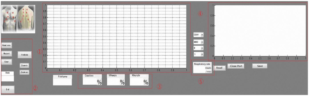 Sensors 15 13132 g005 1024