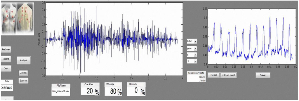 Sensors 15 13132 g018 1024