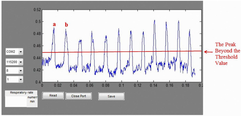 Sensors 15 13132 g022 1024
