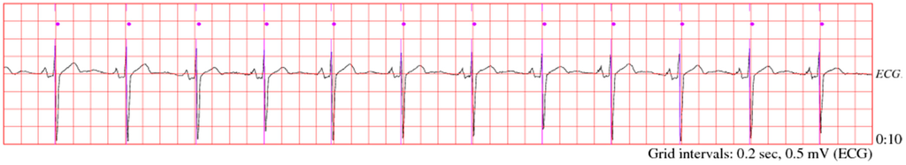 Sensors 15 15067 g007 1024
