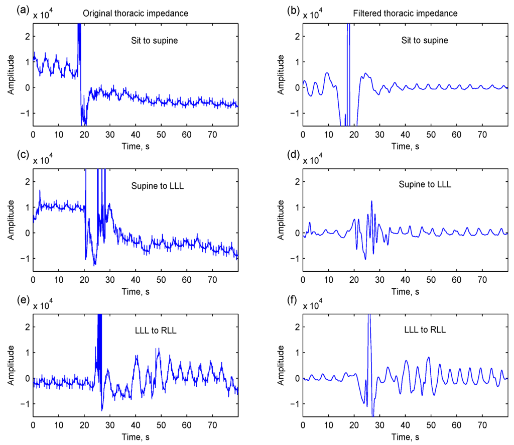 Sensors 15 16372 g001 1024