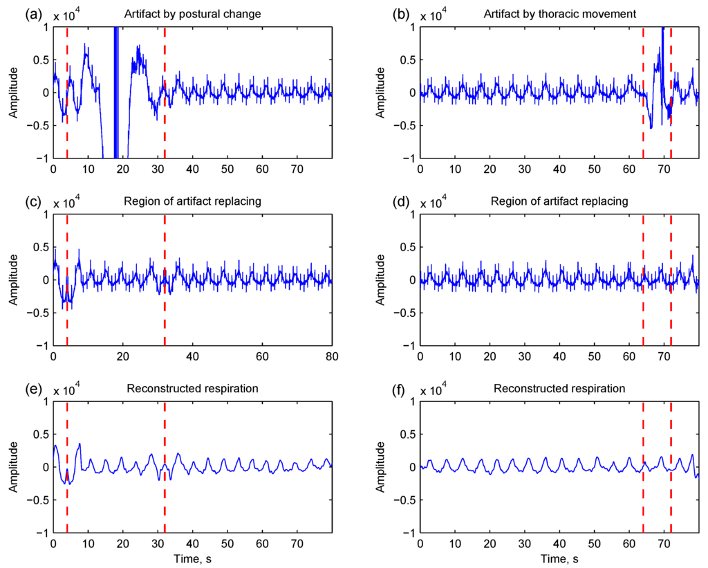 Sensors 15 16372 g004 1024