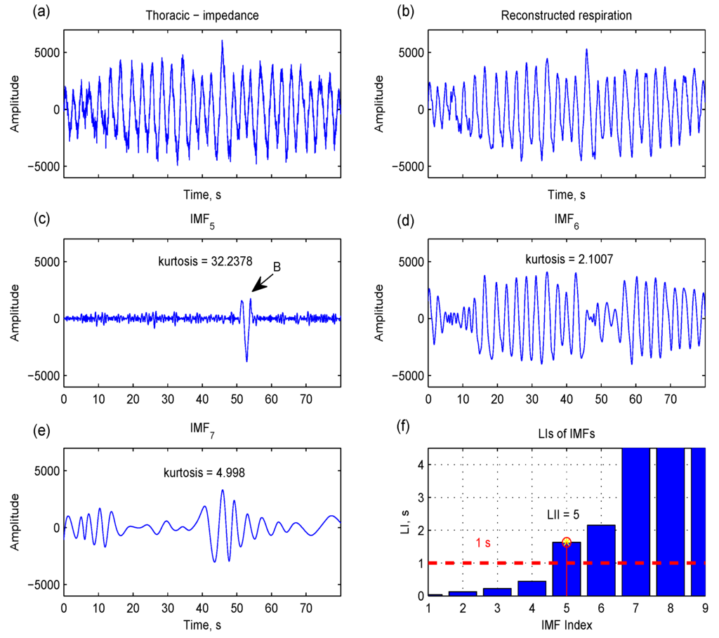 Sensors 15 16372 g007 1024